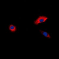ADRB1 Antibody (Internal)