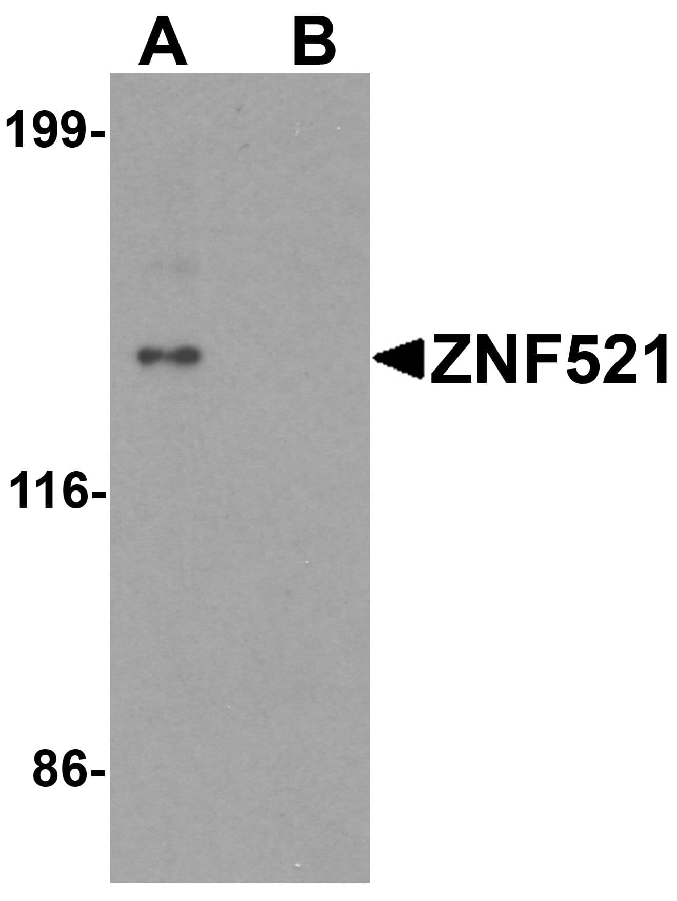 IHC-plus™ ZNF521 Antibody