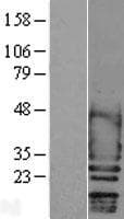 SCN2B Protein (Over-Expression Lysate Myc-DDK (Flag))