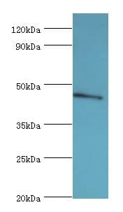 STK32A Antibody (aa1-166)