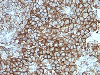Melanoma Antibody (clone KBA.62, Ready-to-Use)