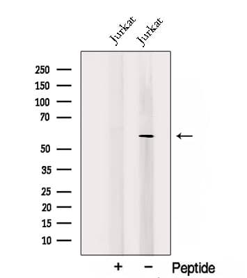 Polyclonal Rabbit anti-Human TRAF5 Antibody (WB)