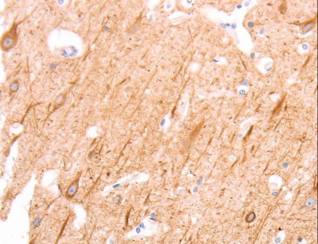 Polyclonal Rabbit anti-Human INA / Alpha Internexin Antibody (IHC, WB)