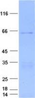 Human HPN / TMPRSS1 / Hepsin Protein (Recombinant GST, N-terminus + His, C-terminus)