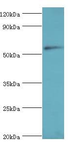 Polyclonal Rabbit anti-Human CNDP1 Antibody (aa1-280, WB)