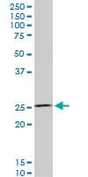 HOXC12 Antibody (clone 1C6)