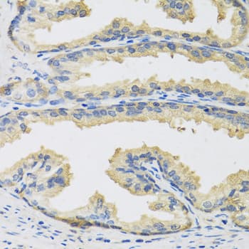 CST3 / Cystatin C Antibody