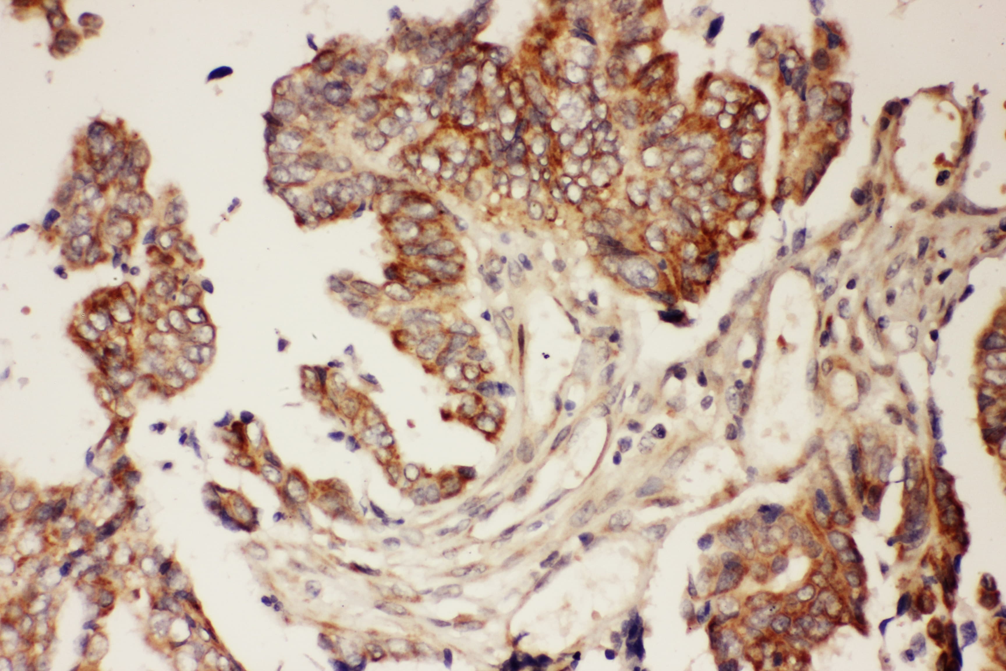 CNTF Antibody (aa2-200)