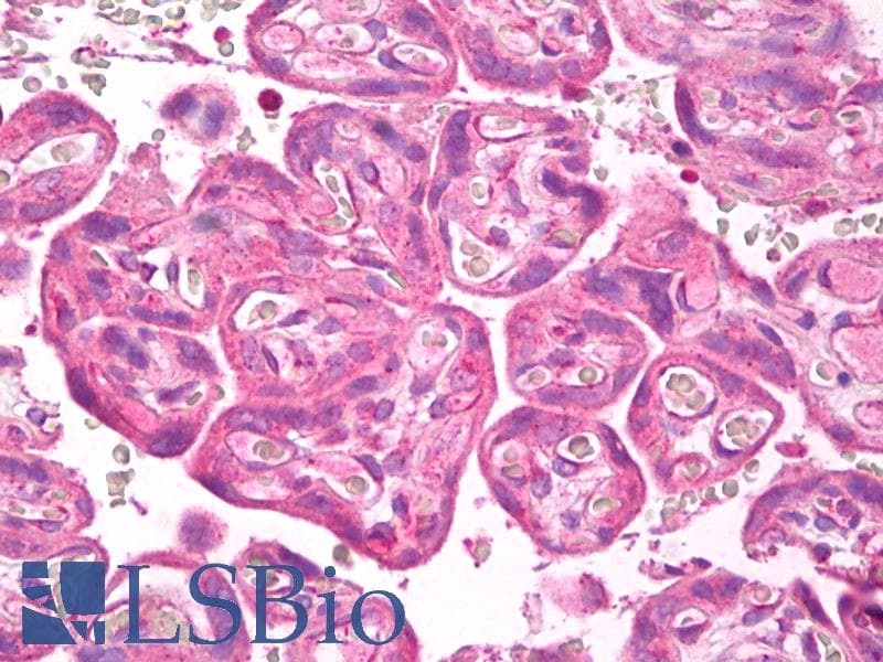 IHC-plus™ FLT1 / VEGFR1 Antibody (Internal)