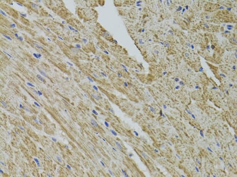 Polyclonal Rabbit anti-Human FHIT Antibody (IHC, WB)
