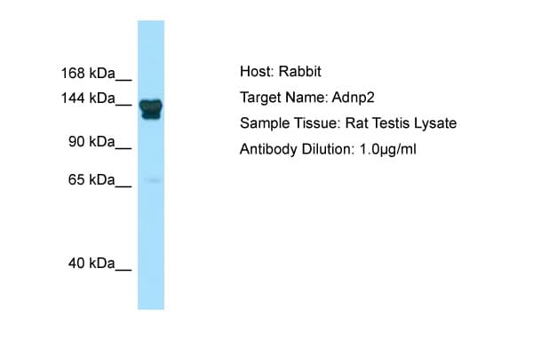 ADNP2 Antibody (N-Terminus)