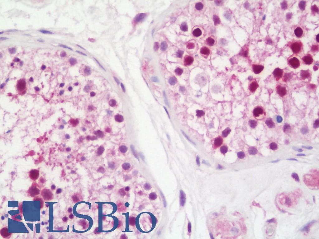 IHC-plus™ Polyclonal Rabbit anti-Human KIF2C / MCAK Antibody (aa50-100, IHC)
