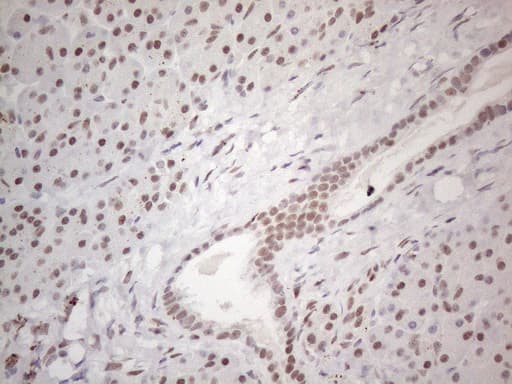 TP53BP1 / 53BP1 Antibody (aa1-300, clone OTI5E1)
