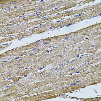 FLNB / TAP Antibody