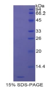 Human DEFA3 / Defensin Alpha 3 Protein (Recombinant His)