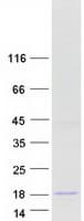 Human SPAG11B Protein (Recombinant Myc-DDK (Flag))