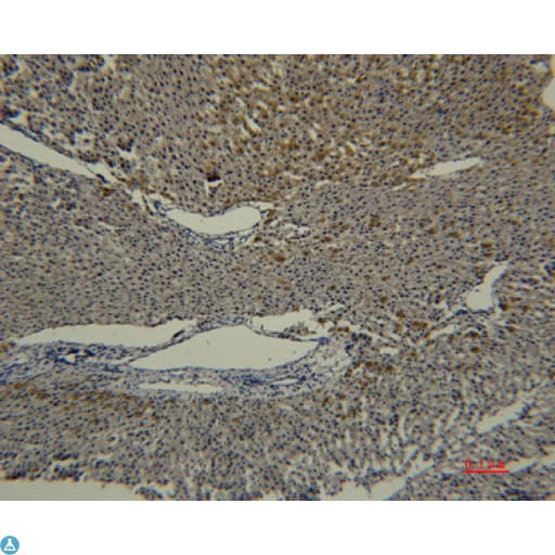 TF / Transferrin Antibody