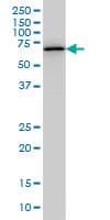 Monoclonal Mouse anti-Human OXSR1 / OSR1 Antibody (clone 1B9, IHC, IF, WB)