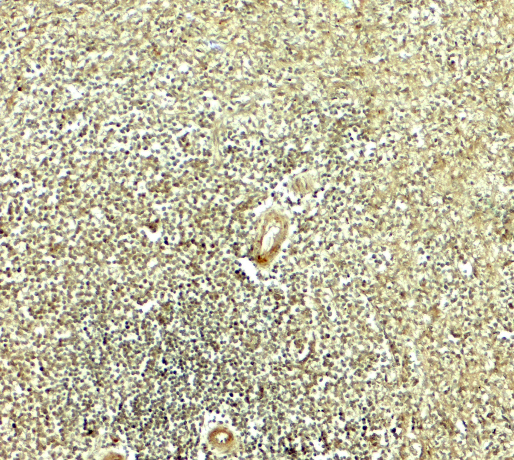 IKZF2 / HELIOS Antibody