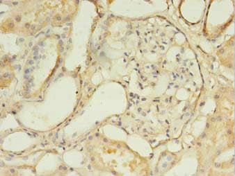DLEU1 Antibody