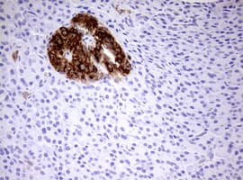 HADH Antibody (aa57-314, clone OTI1D4)