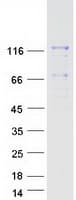 Human MAN2B2 Protein (Recombinant Myc-DDK (Flag))