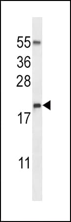 IHC-plus™ RNASE3 Antibody (aa124-151)