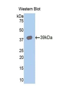 KRT15 / CK15 / Cytokeratin 15 Antibody (aa94-402)