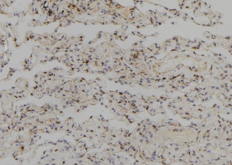 SYCP2 / SCP-2 Antibody