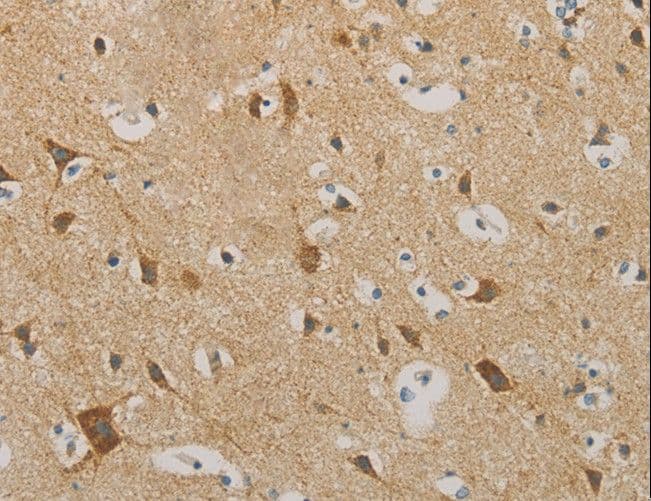 IDH3G Antibody