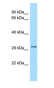 FLVCR2 Antibody (C-Terminus)