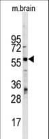 Polyclonal Rabbit anti-Human ZBTB7B / HcKrox Antibody (aa181-210, IHC, WB)