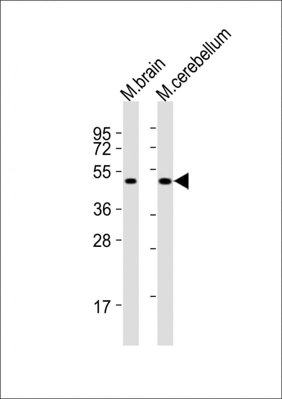 Polyclonal Rabbit anti-Human PORCN Antibody (aa138-171, WB)