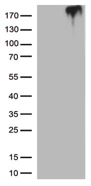 MST1R / RON Antibody (aa25-304, clone OTI1D12, Carrier-free)