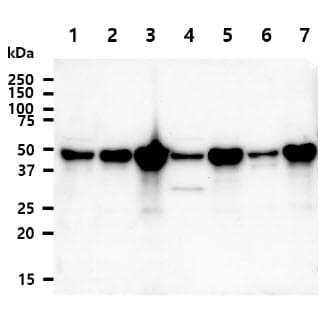 IHC-plus™ NDRG1 Antibody (clone AT11G4)