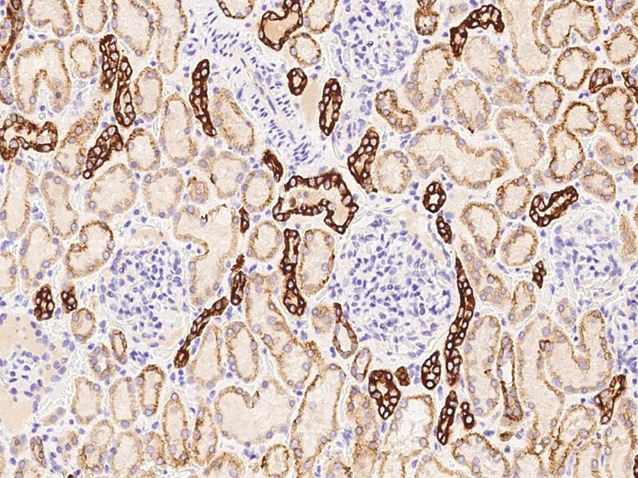KRT76 / Keratin 76 Antibody (Preservative Free)