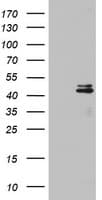 OTC Antibody (aa33-354, clone OTI4H2, Carrier-free)