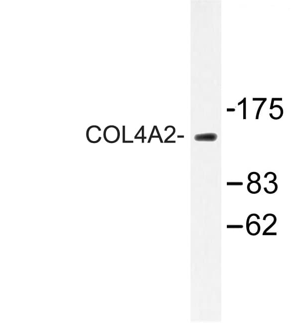 COL4A2 / Collagen IV Alpha2 Antibody (Pro175)