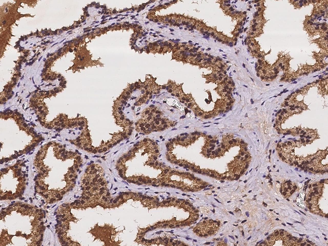 CRISPLD1 Antibody