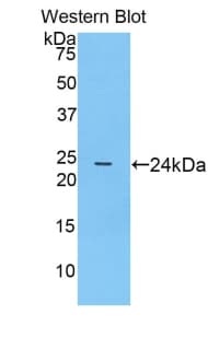 PTGS1 / COX-1 Antibody (aa407-602)