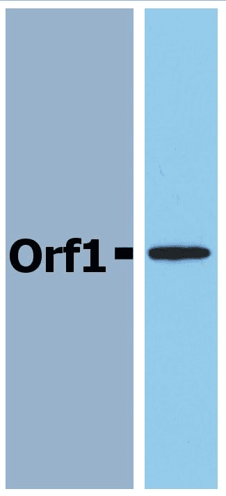 Neisseria meningitidis Orf1 Antibody (clone Polyclonal)