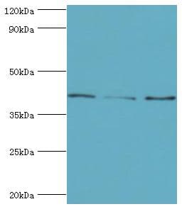 SERPINB5 / Maspin Antibody (aa21-189)
