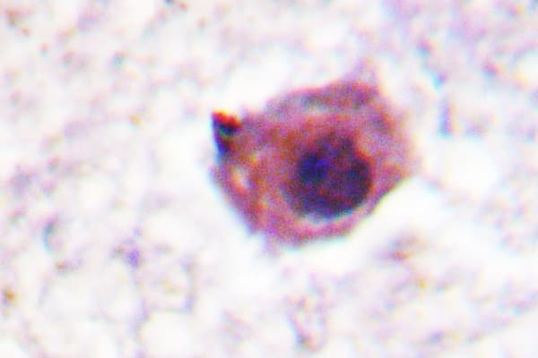 SGK1 / SGK Antibody (Pro73)
