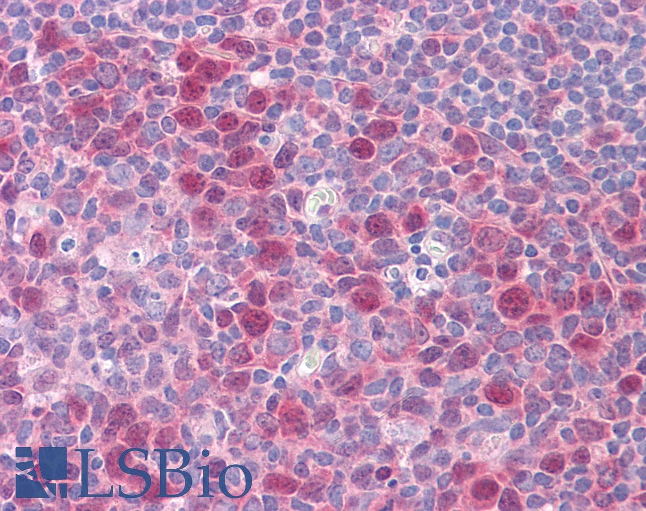 IHC-plus™ Monoclonal Mouse anti-Human CSE1L Antibody (clone 3F8, IHC, IF, WB)