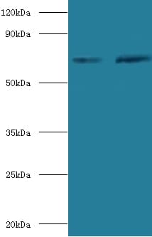 SDHA Antibody