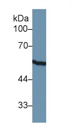 KRT8 / CK8 / Cytokeratin 8 Antibody (aa399-483)