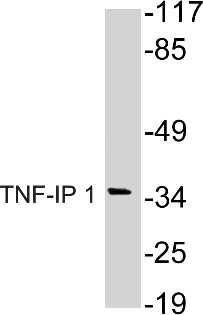 TNFAIP1 Antibody (Ser122)