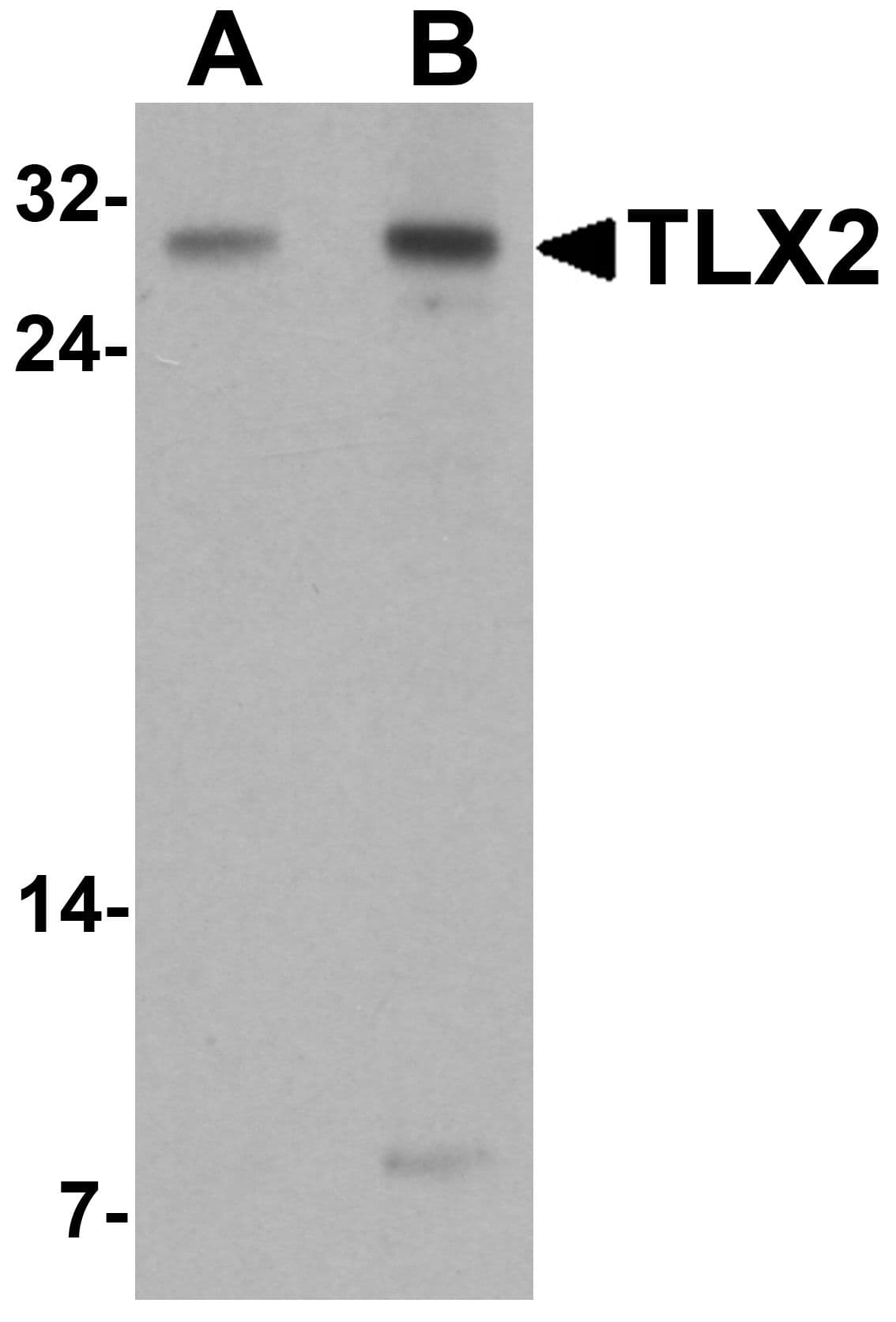 IHC-plus™ Polyclonal Rabbit anti-Human TLX2 / NCX Antibody (IHC, IF, WB)