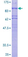 Human SNK / PLK2 Protein (Recombinant GST)