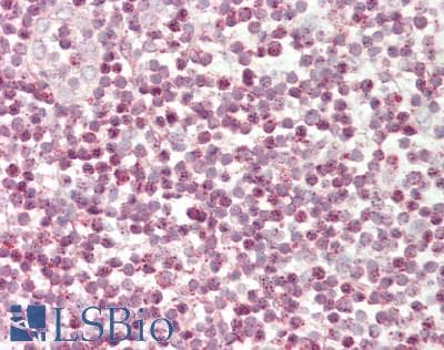 TFCP2 / CP2 Antibody (aa38-87)